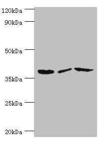 Anti-P2RY14 Antibody