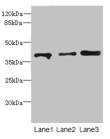 Anti-GABPB1 Antibody