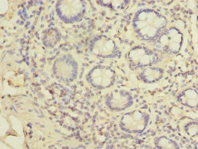 Anti-EIPR1 Antibody
