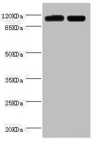 Anti-PITRM1 Antibody