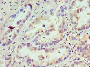 Anti-CDCA8 Antibody