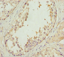 Anti-EFHC1 Antibody