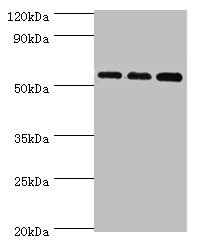 Anti-ACSM3 Antibody