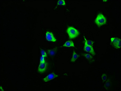 Anti-SYT6 Antibody