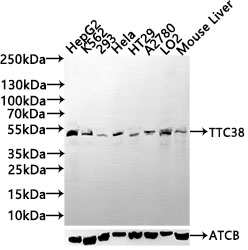 Anti-TTC38 Antibody