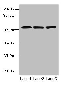 Anti-INTS11 Antibody