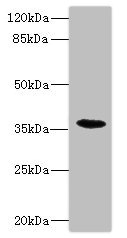 Anti-BST1 / CD157 Antibody