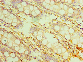 Anti-IL20RB Antibody