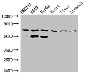 Anti-TCTN3 Antibody