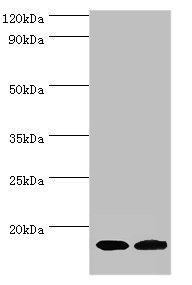 Anti-CPLX2 Antibody