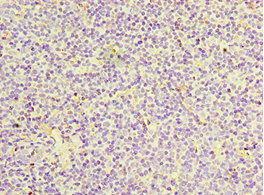 Anti-IL27RA Antibody