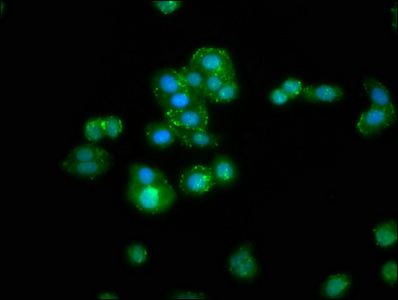 Anti-RBMS3 Antibody
