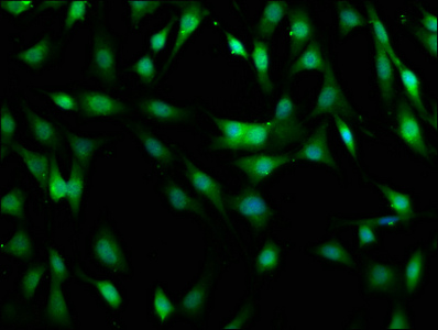 Anti-MOB1B Antibody