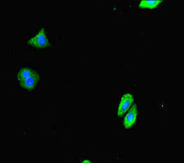 Anti-DTX4 Antibody
