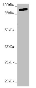 Anti-TTLL7 Antibody