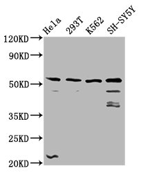 Anti-RUFY3 Antibody
