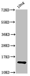 Anti-Protein C Antibody