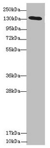 Anti-NPHP3 Antibody