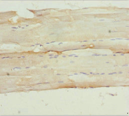 Anti-NPHP3 Antibody