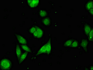 Anti-PARG Antibody