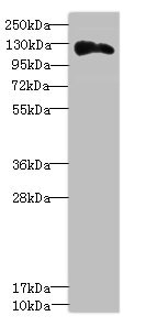 Anti-ANLN Antibody