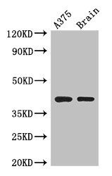 Anti-SEPT12 Antibody