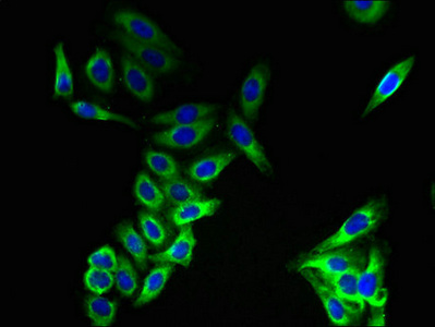 Anti-CMTM8 Antibody