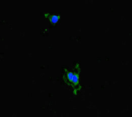 Anti-ALDH16A1 Antibody