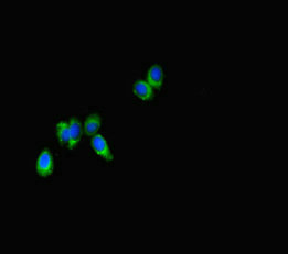 Anti-SPNS2 Antibody