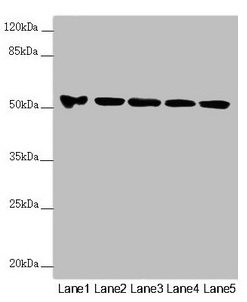 Anti-FOXRED1 Antibody