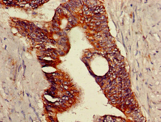 Anti-TRPV1 Antibody