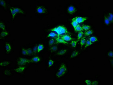 Anti-ATP6V1E2 Antibody