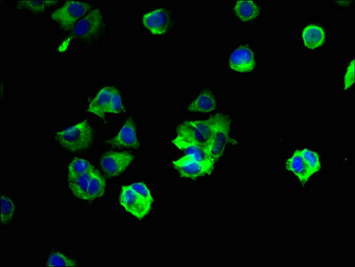 Anti-YIPF6 Antibody