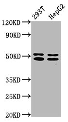 Anti-TRNT1 Antibody