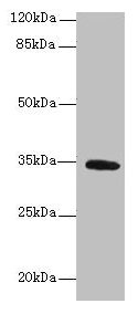 Anti-SETD9 Antibody