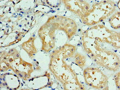 Anti-DEDD2 Antibody