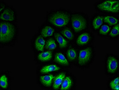 Anti-TAS1R2 Antibody