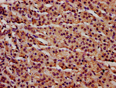 Anti-IFT140 Antibody
