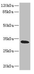 Anti-HVCN1 Antibody