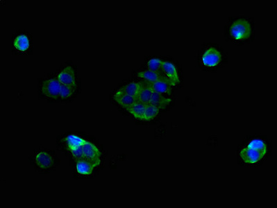 Anti-SLC25A38 Antibody