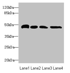 Anti-TXNDC5 Antibody