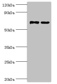 Anti-MTMR14 Antibody