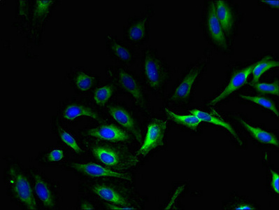 Anti-GPX8 Antibody