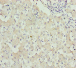Anti-WDR45 Antibody