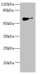 Anti-SLC22A8 Antibody