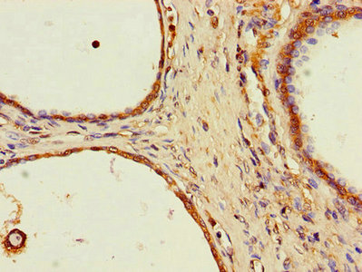 Anti-SPPL2A Antibody