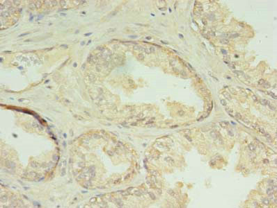 Anti-CHMP7 Antibody