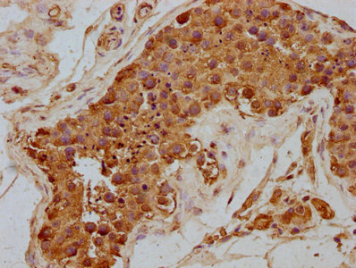Anti-RUBCN Antibody