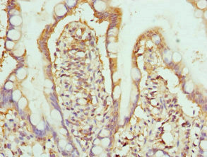 Anti-HPS1 Antibody