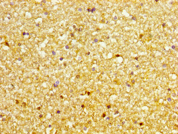 Anti-DVL3 Antibody